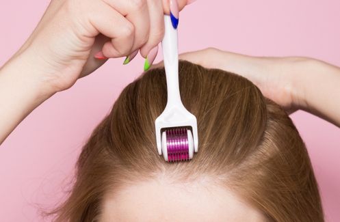 Thinning hair? Receding hairline? This micro needling scalp treatment promotes hair growth