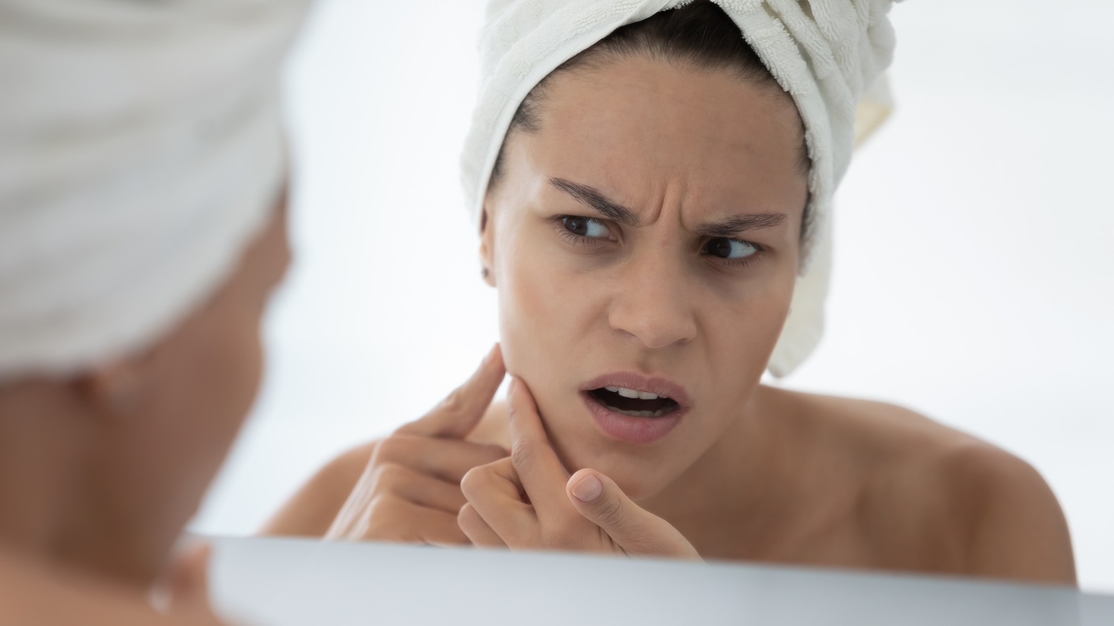 Why A Pus-Filled Pimple Isn’t Bad News – Health Digest