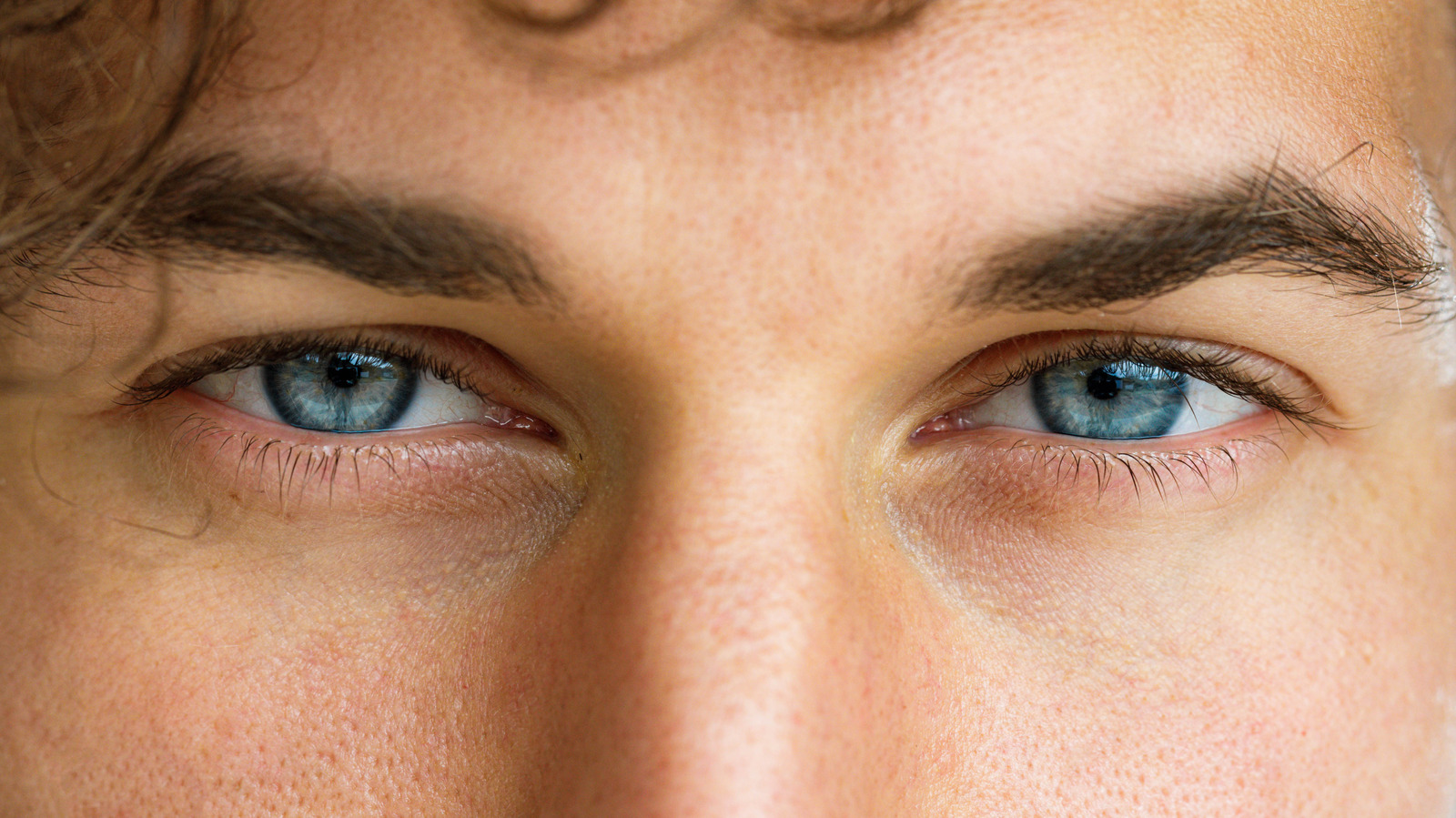 People With Blue Eyes Are More Likely To Develop This Medical Condition – Health Digest