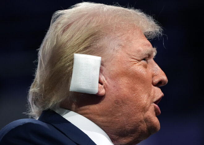 Could Donald Trump’s Ear Injury Cause Lasting Damage? – Health Digest