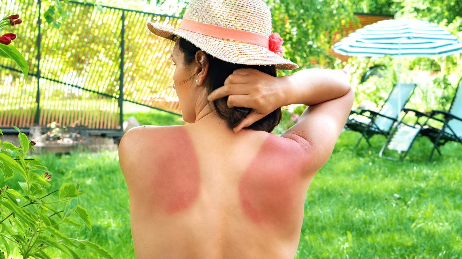 Should You Take Ibuprofen After Getting A Bad Sunburn? Here’s What We Know – Health Digest