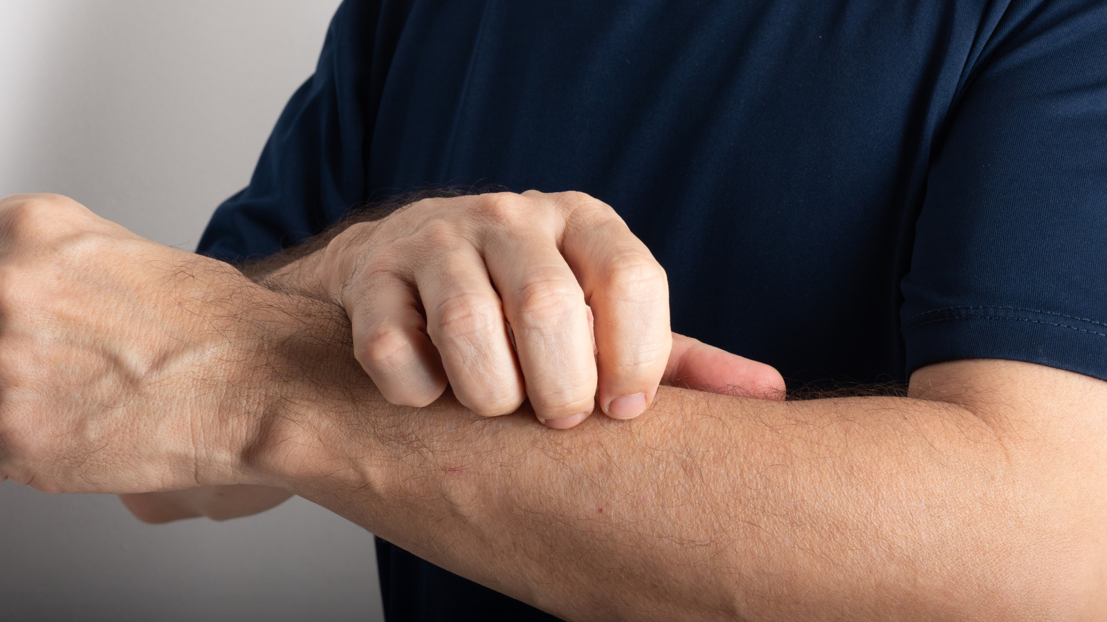 The Commonly Mistaken Sign Of Shingles You Shouldn’t Ignore – Health Digest